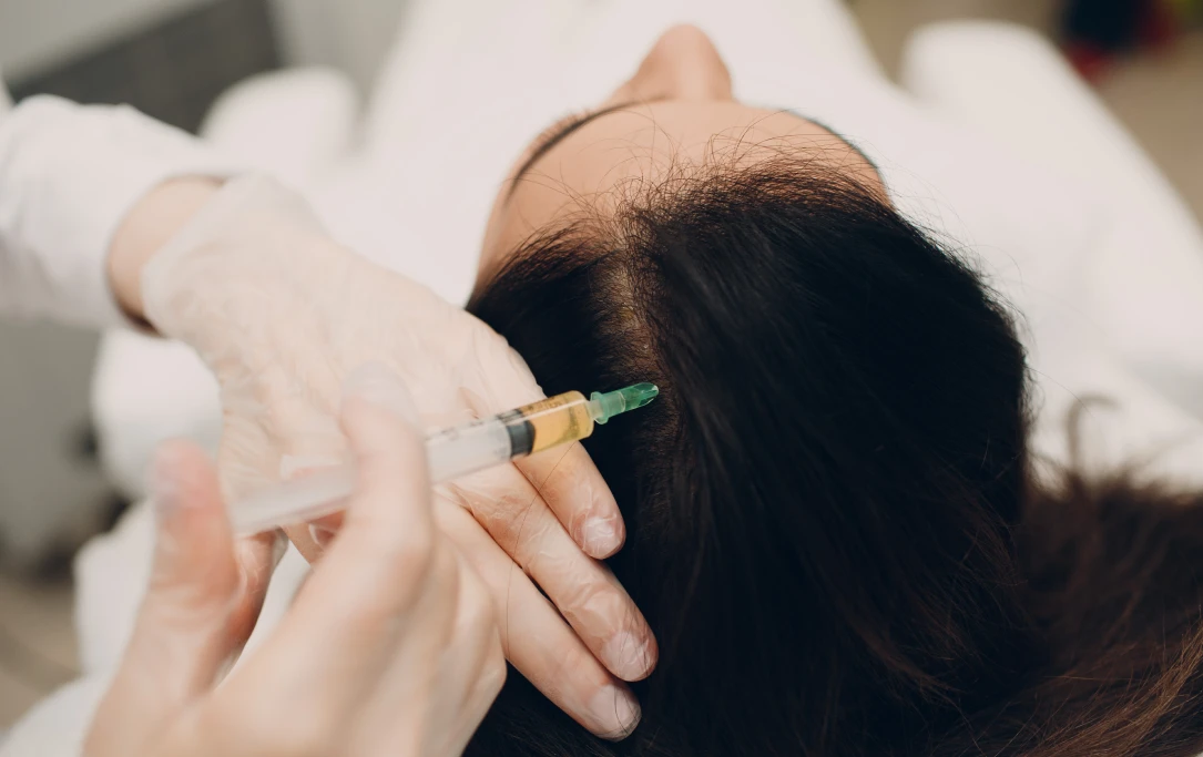  injection for hair treatment - La Densitae Lucknow